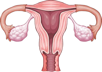 عکس دوربری تخمدان رحم سیستم تولید مثل