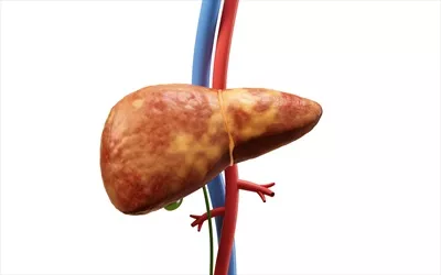 عکس مدل سه بعدی کبد با وضعیت چربی کبد: بررسی عمیق و علمی