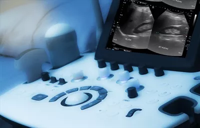 عکس تصویری نزدیک از دستگاه سونوگرافی و تصویر کلیه راست در پس زمینه پزشکی