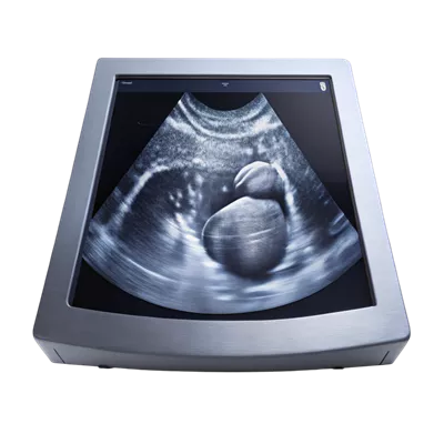 عکس دوربری تصویری واضح از ساختار داخلی بدن در اسکن سونوگرافی بر روی مانیتور پزشکی