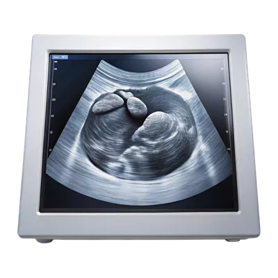 عکس دوربری تصویری نزدیک از صفحه سونوگرافی با جزئیات واضح برای معاینه پزشکی