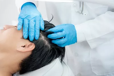 عکس متخصص بررسی سلامت مو برای مردان آسیایی با مشکلات ریزش و نازک شدن مو