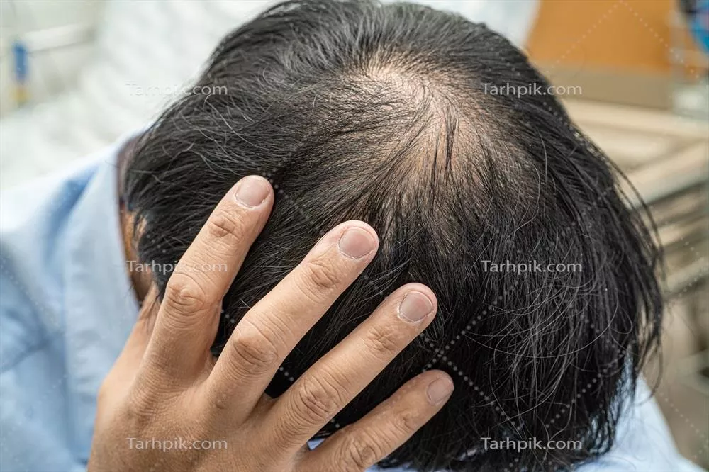عکس مردی با سر طاس و با اعتماد به نفس در محیط کار فعال و هوشمند