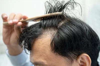 عکس مردی با سر طاس و با اعتماد به نفس در محیط کار، نماد موفقیت