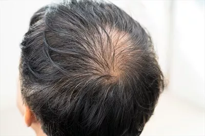 عکس مردی با سر طاس و با اعتماد به نفس در محیط کار مدرن