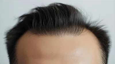 عکس پرتره ای نزدیک از مردی متفکر با سر طاس در پس زمینه ای ملایم