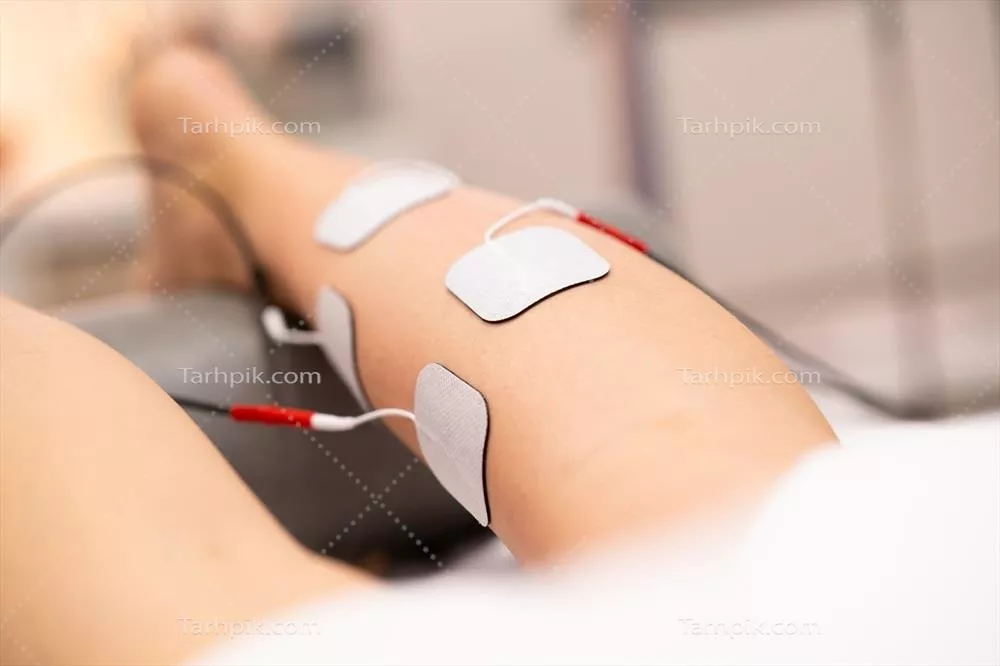 عکس تحریک الکتریکی در فیزیوتراپی برای جوانان: روشی نوین و مؤثر