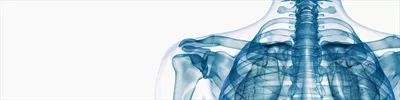 عکس تصویری از اشعه ایکس تولید شده توسط هوش مصنوعی برای نمایش تجهیزات پزشکی حفاظتی در تشخیص های رادیولوژی