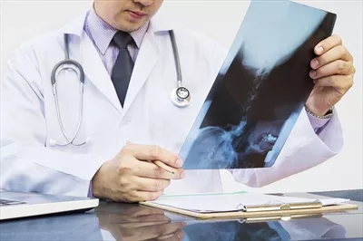 عکس پزشک در حال بررسی تصویر اشعه ایکس بر روی پس زمینه سفید