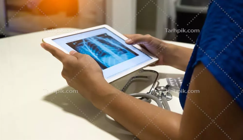 عکس پزشک در حال بررسی تصویر اشعه ایکس قفسه سینه برای تشخیص پزشکی