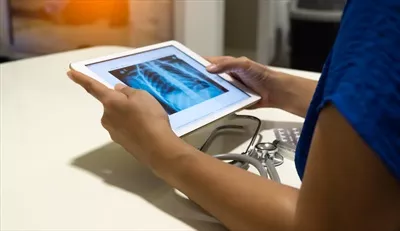 عکس پزشک در حال بررسی تصویر اشعه ایکس قفسه سینه برای تشخیص پزشکی