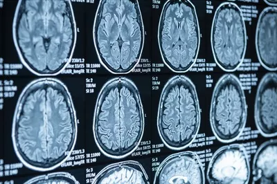 عکس تصویربرداری MRI و سی تی اسکن از ناحیه کمر در بیمارستان