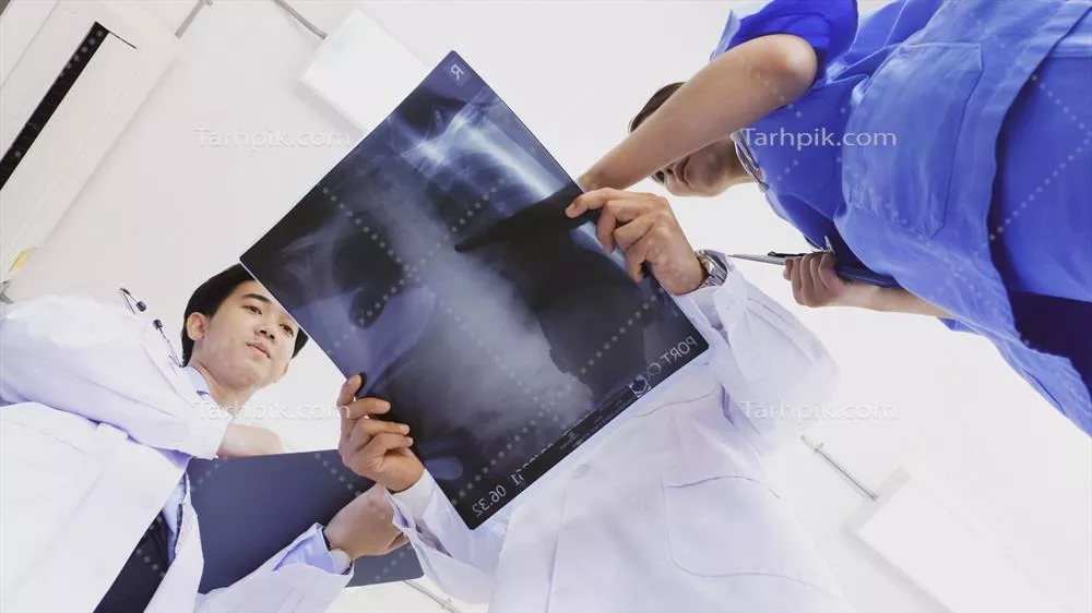 عکس پزشک و دستیاران پزشکی در حال بررسی نتایج تشخیصی بر روی فیلم اشعه ایکس