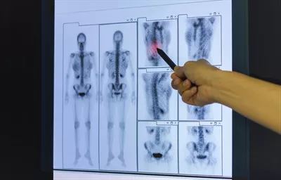 عکس پزشک در حال نشان دادن نقاط کلیدی بر روی تصویر اشعه ایکس اسکلت