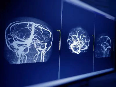 عکس تصویری جامع از آناتومی مغز و عضلات دو طرفه در نواحی پاریتال و مخچه