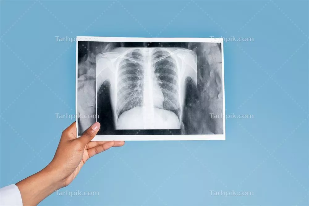 عکس دست یک زن پزشک جوان سیاه پوست در حال ارائه خدمات پزشکی