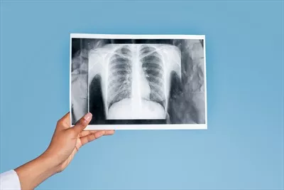 عکس دست یک زن پزشک جوان سیاه پوست در حال ارائه خدمات پزشکی