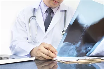 عکس پزشک در حال بررسی تصویر اشعه ایکس بر روی پس زمینه سفید