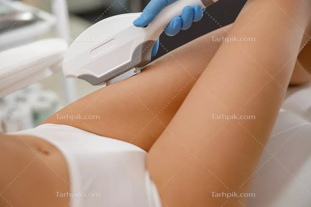 عکس زنی با پوست صاف در حال اپیلاسیون پاها با دستگاه IPL در سالن زیبایی