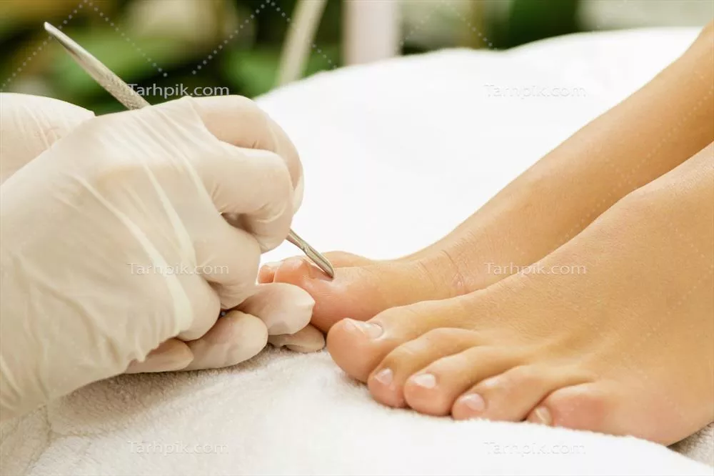 نزدیکنگری به کار متخصص پدیکور با ابزار فولادی ویژه و دستان زنانه در دستکش