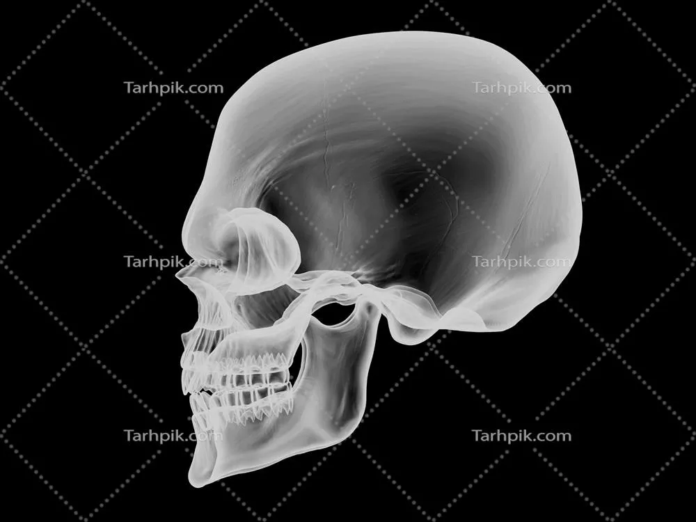 تصویر اشعه ایکس از نمای جانبی جمجمه با جلوه‌های بصری حیرت‌انگیز
