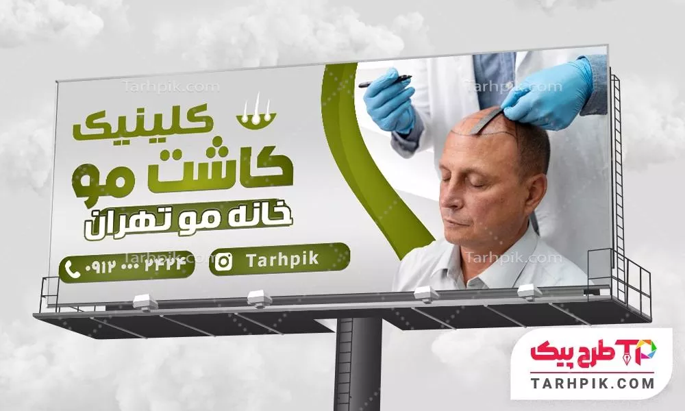 بنر طرح کلاسیک کاشت مو به صورت لایه باز