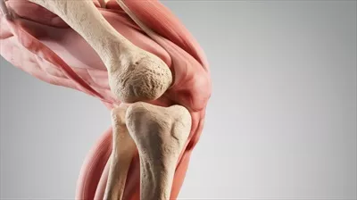 عکس مدل سه بعدی زانو با ویژگی های آرتروز برای بررسی پزشکی