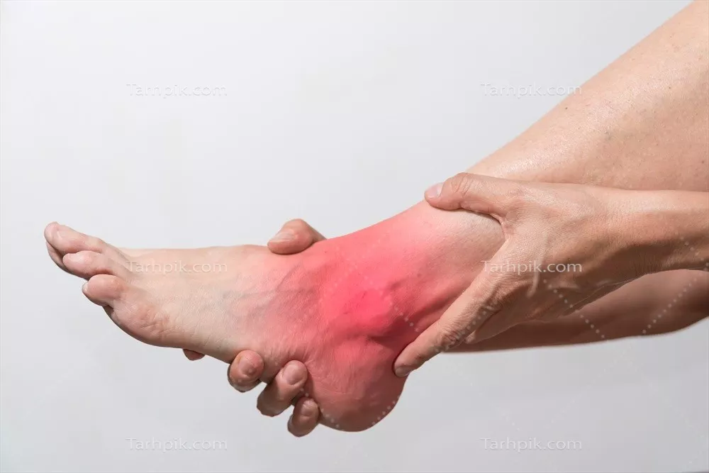 عکس درد مفصل مچ پا، آرتروز و مشکلات تاندون - مراقبتهای بهداشتی